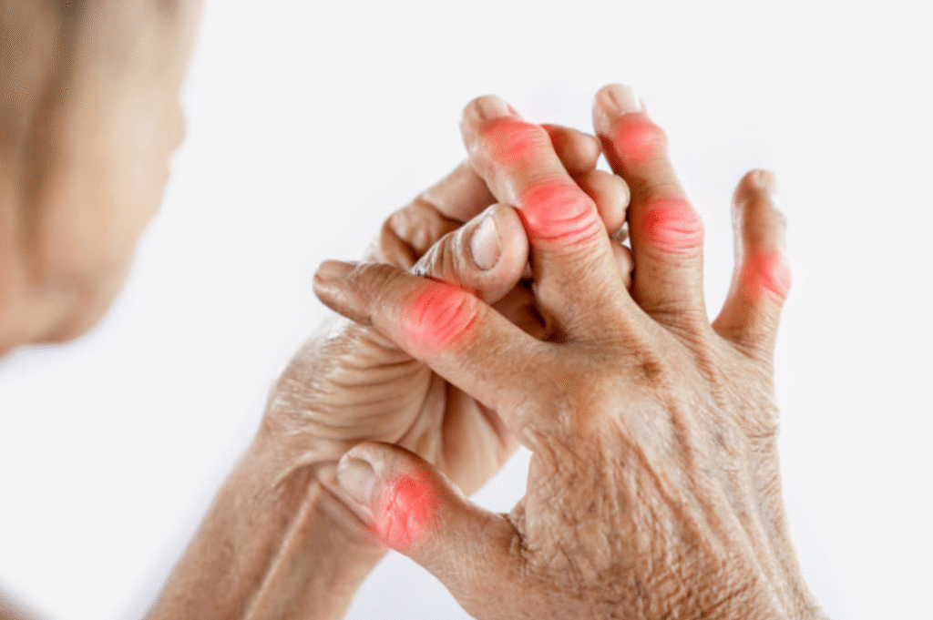 manos de adulto mayor con dolor en articulaciones